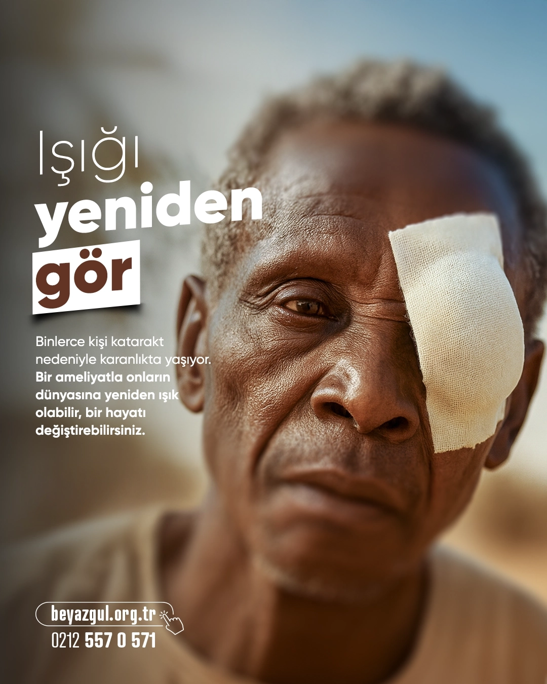 Katarakt Ameliyatı